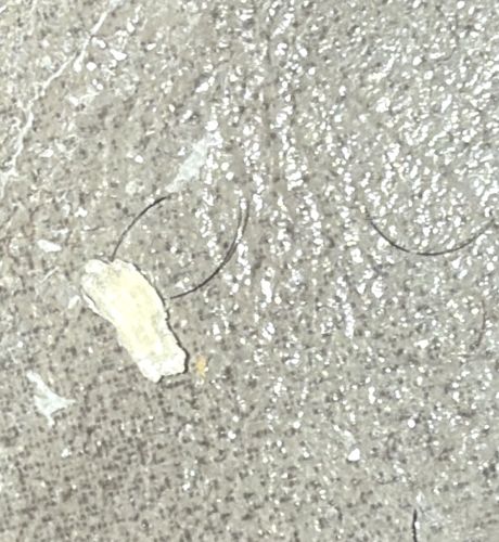 Not a Bug (Skin Flake or Debris)