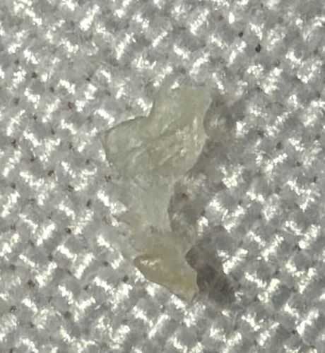 Skin Flake / Dried Skin / Sebum (Not an insect)