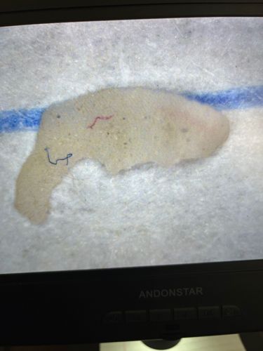 Unidentifiable Debris