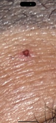 Hard tick