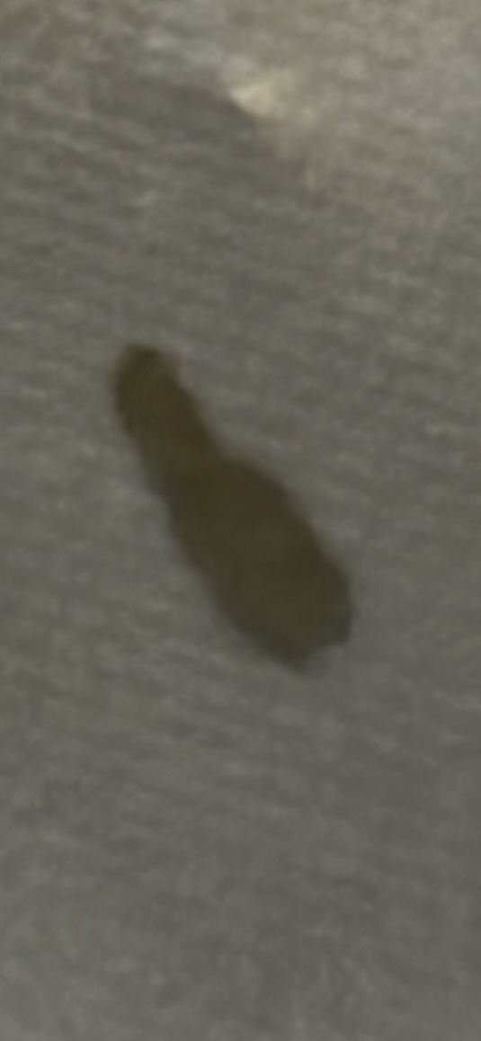 Case-bearing clothes moth (larva)
