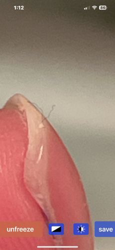 It is not possible to identify an insect from the provided image. The image shows what appears to be a small fiber or hair on a surface, not an insect.