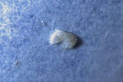 Sebum Plug / Keratin Debris (Not a bug)