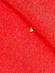 Insect/Arthropod Egg (Possible)