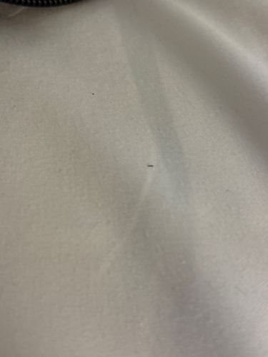 Unable to identify - possibly dust or lint on fabric