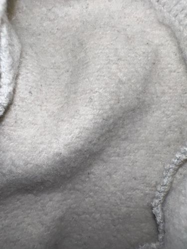 No insect/bug detected