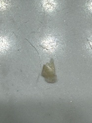 Unidentifiable insect remnant or debris