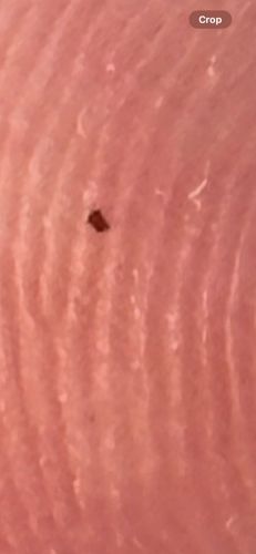 Flea (possibly human flea)