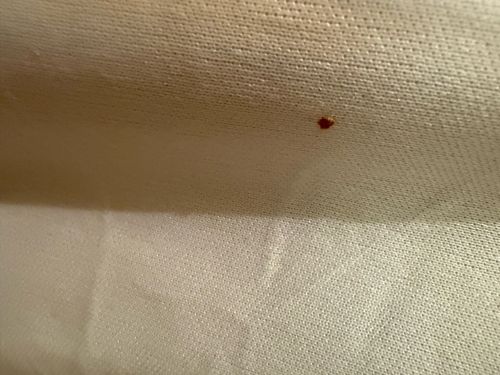 Bed bug (most likely a blood spot from a crushed bed bug)