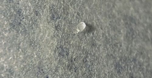 Louse Nit (Head Louse Egg)