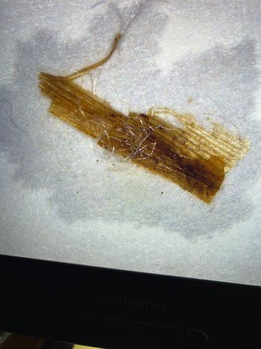 Not identifiable as an insect