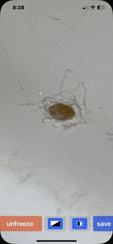 Bed Bug Egg / Nymph