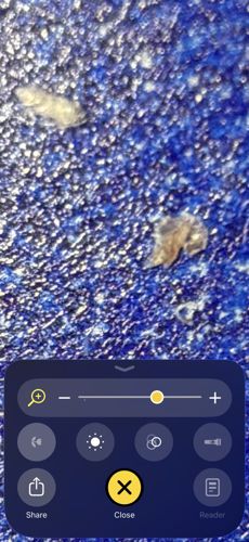 Human Head Louse