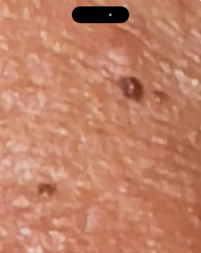 Undetermined / Possible Scab or Artifact (Not clearly an insect)