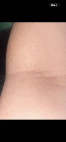 No insect or bug identifiable