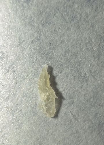 Inconclusive - Likely dried skin or debris showing no arthropod characteristics