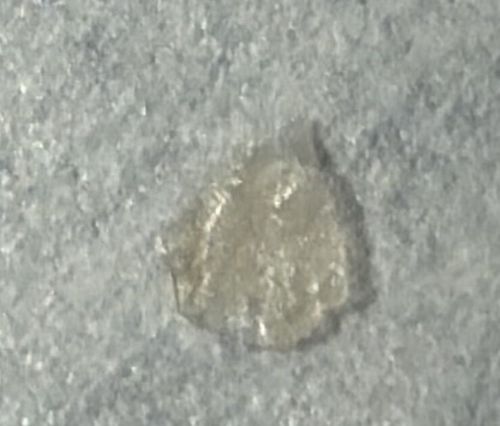 Scabies Mite (or possibly a skin flake/debris resembling one)