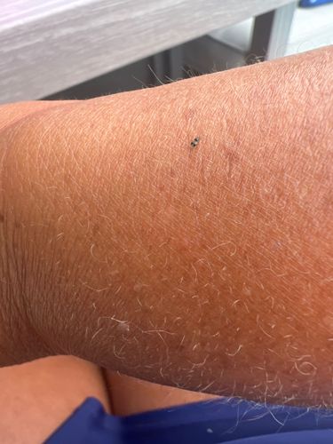 Biting Midge, No-See-Um, Sandfly (though sandfly also refers to other insects)