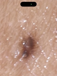 Lone Star Tick