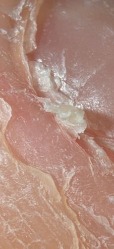 Non-living tissue (Hyperkeratosis/Skin)