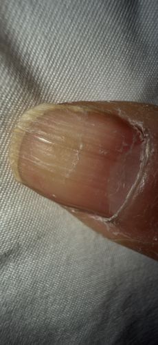 None / Not an insect