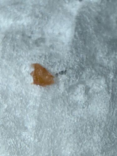 Inconclusive (Likely non-biological debris)