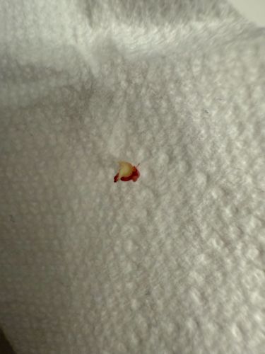 Unidentifiable insect remains/stain