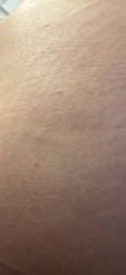Undetermined; Human skin with potential small bumps/irritations