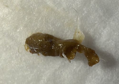 Not an insect (Identify as Mucus/Phlegm Plug or Debris)