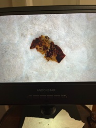 Unidentifiable organic material