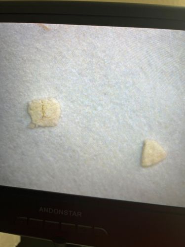 Carpet beetle larvae