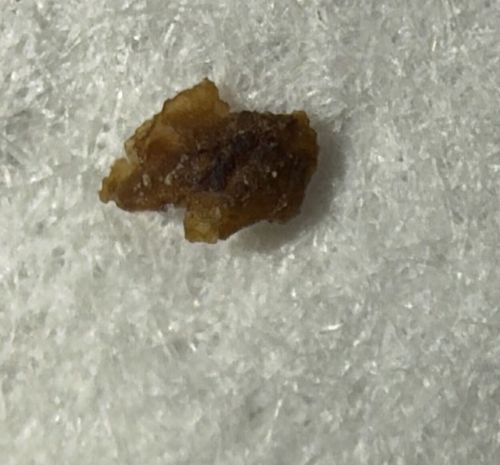 Junk bug (Green lacewing larva)