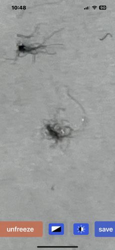 Phorid fly (or Humpbacked fly)