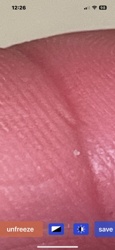 Unable to identify. The image appears to show human skin with a small white object, possibly a speck of debris or part of the skin itself, rather than an insect or bug.