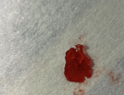 Blood Spot (likely from a squished Bed Bug)