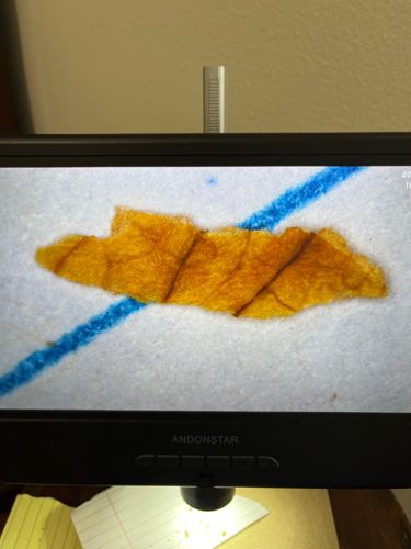 Not identifiable as an insect or bug; appears to be a piece of dried leaf or plant matter