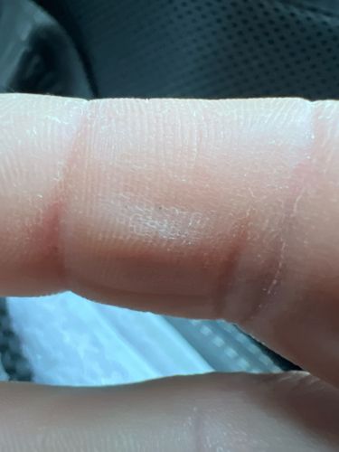 Bird Louse / Chewing Louse