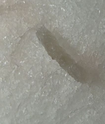 Sarcoptes Scabiei (Scabies Mite Burrow)