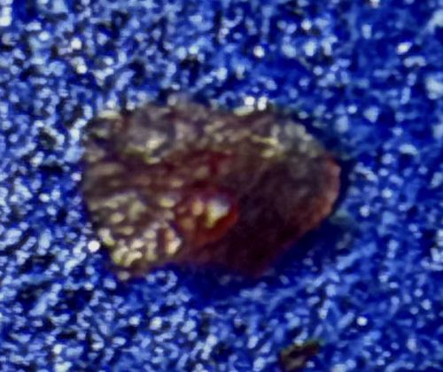 Debris / Lint / Scab (Inconclusive - Not an Insect)