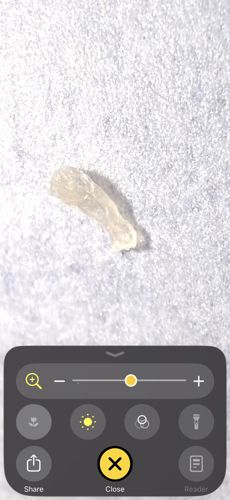 Skin Fragment (Non-Insect)