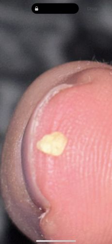 Not identifiable as an insect or bug