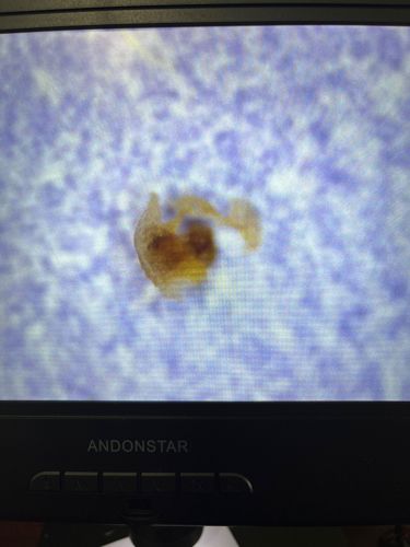 Unidentifiable microscopic organism or artifact