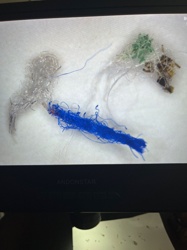 Carpet Beetle Larva (possibly Varied Carpet Beetle or Black Carpet Beetle)