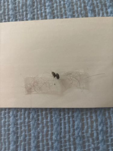 Booklouse (or Psocid)