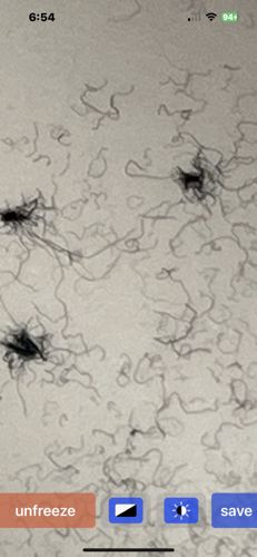 Eye Floaters (or Muscae volitantes)