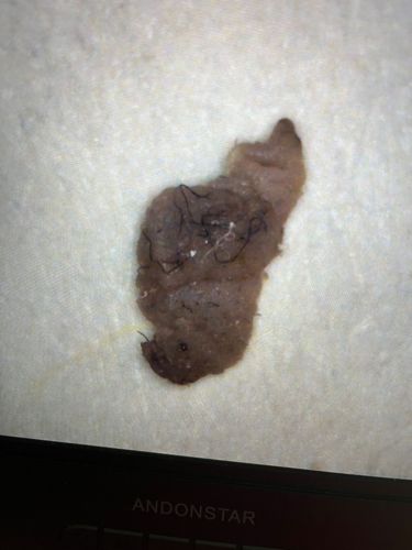 Carpet Beetle Larva (likely Black Carpet Beetle)