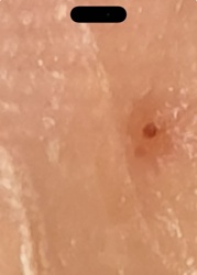 Hard Tick