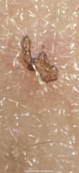 Debris-carrying Lacewing Larva (Junk Bug)