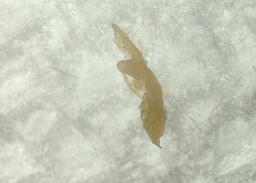 Body Louse (or possibly Head Louse)