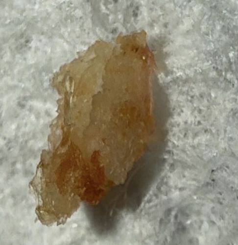 Not a bug/insect (Likely Earwax or Dried Residue)